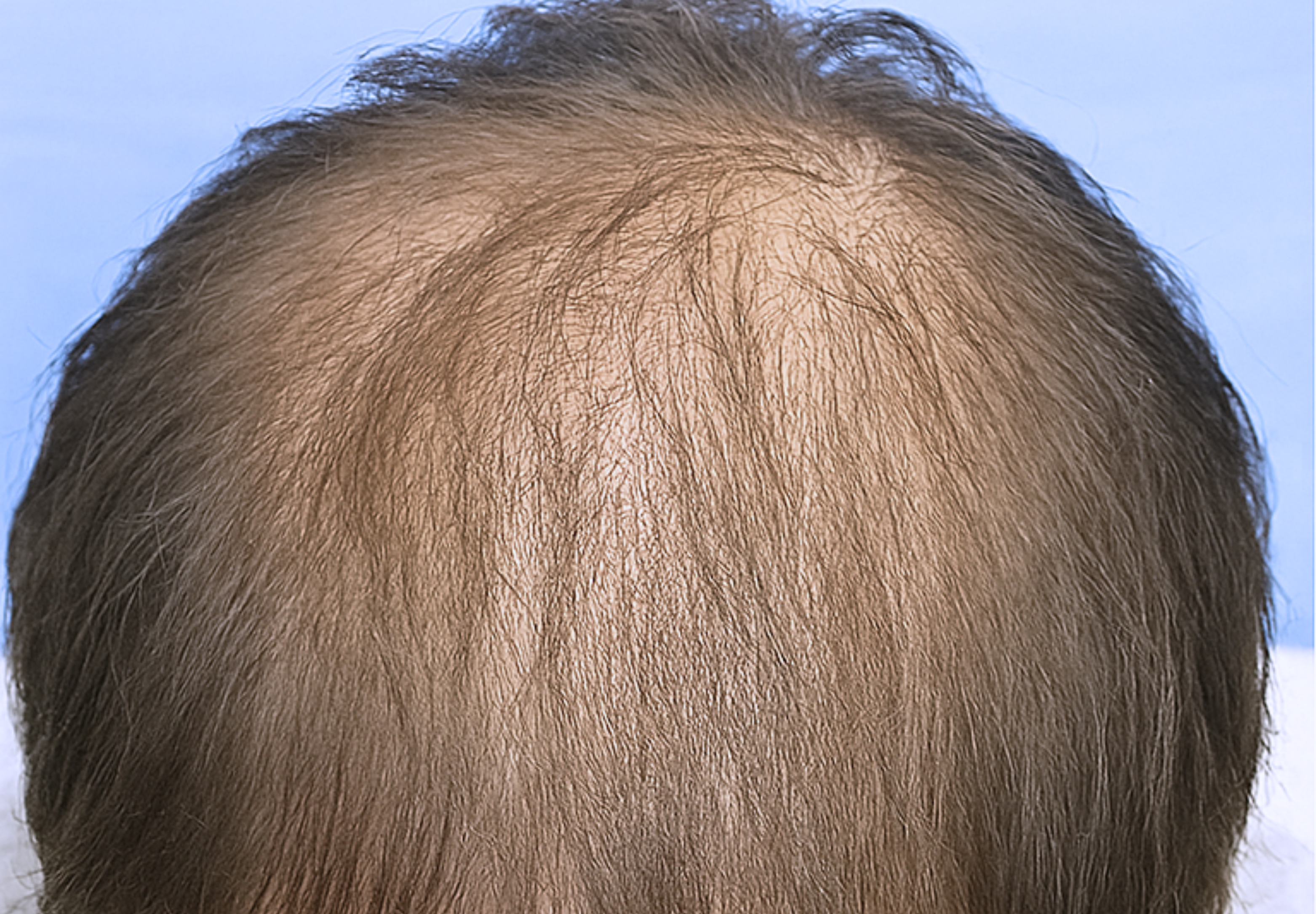 After Image