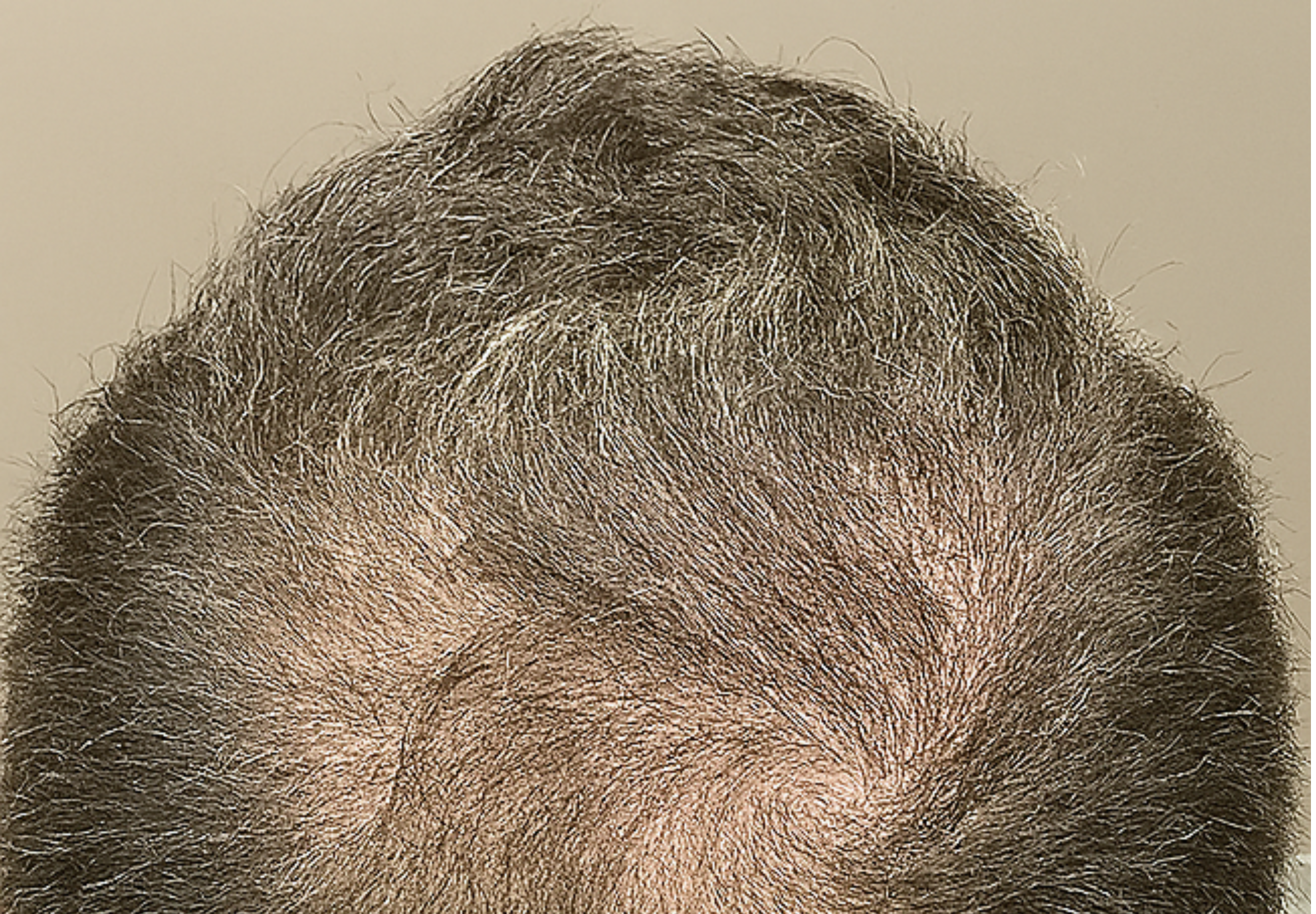 After Image