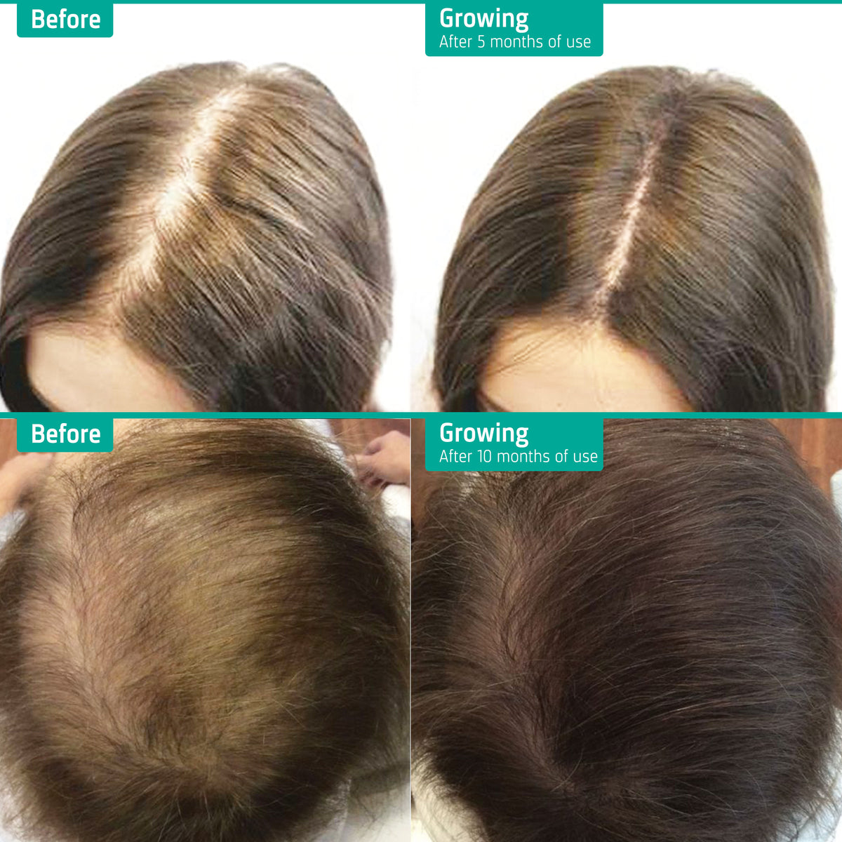 Hair Growth Lotion 90ml