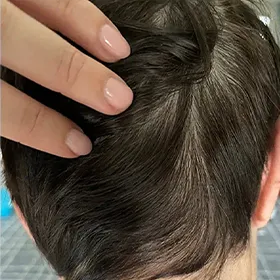 Before Image