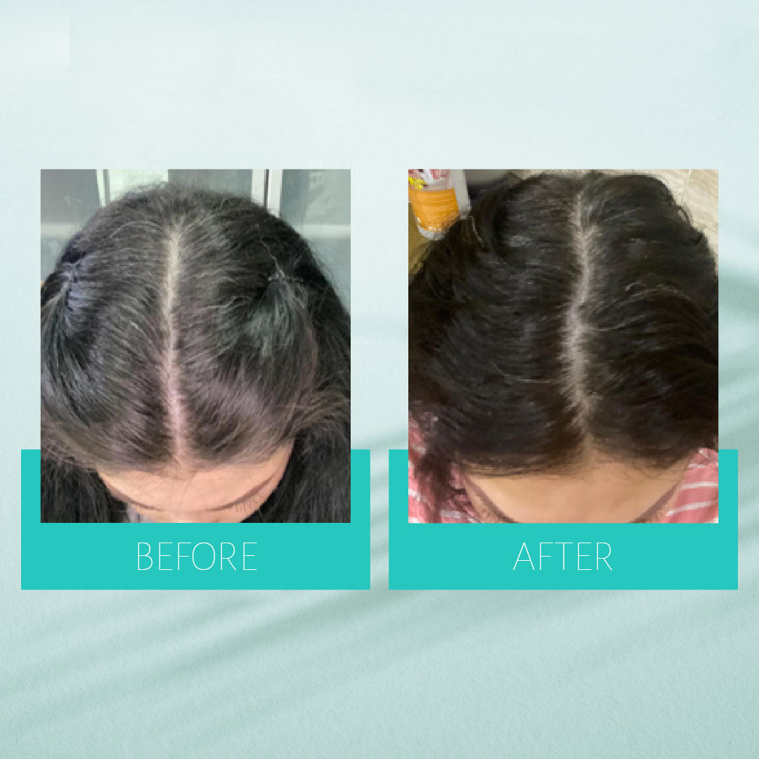 Anti Grey Hair Serum 90ml