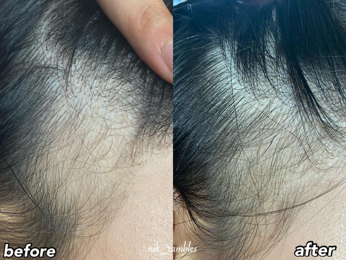 Hair Growth Set