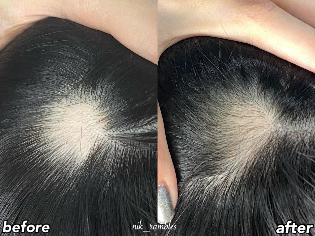 Hair Growth Set