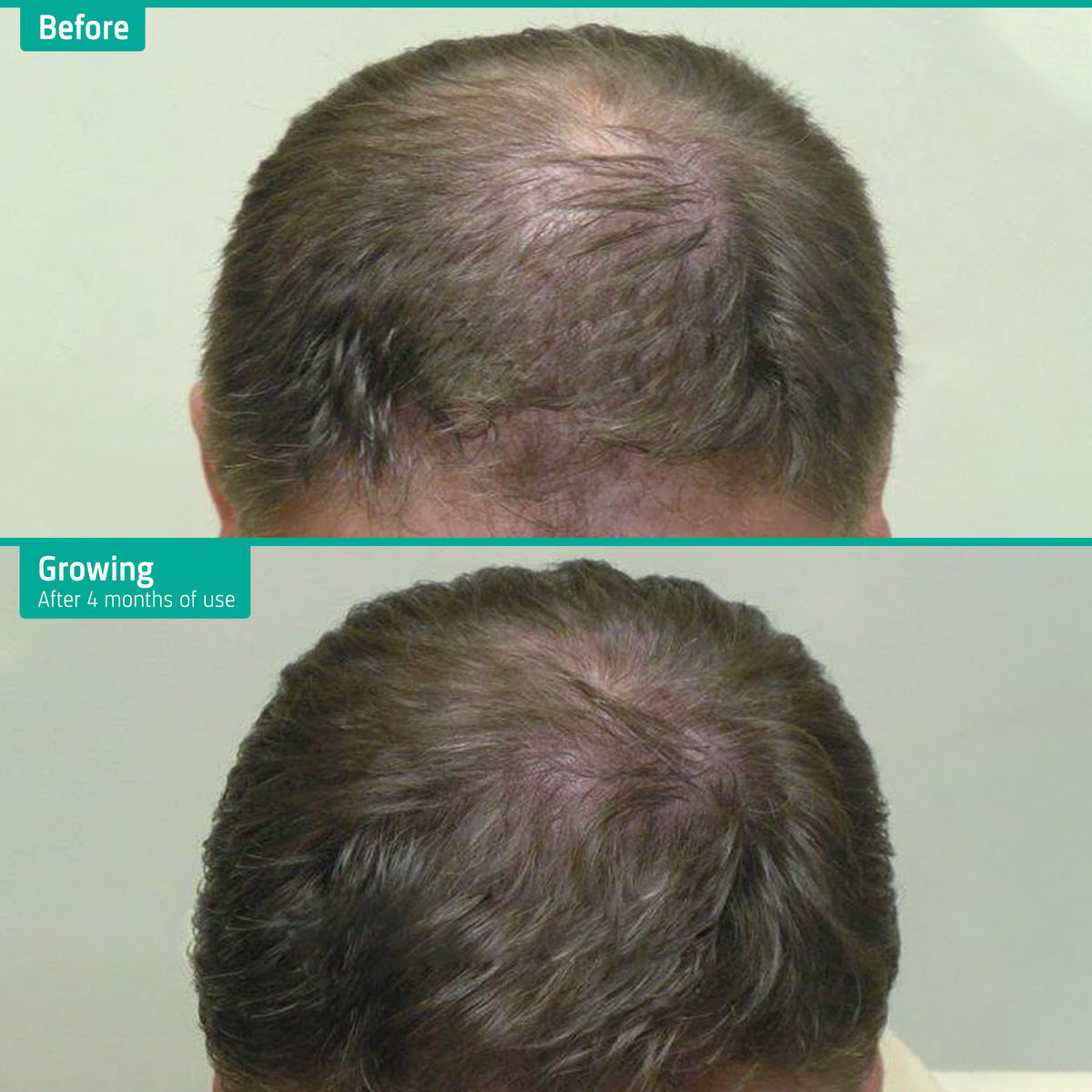 Hair Growth Shampoo