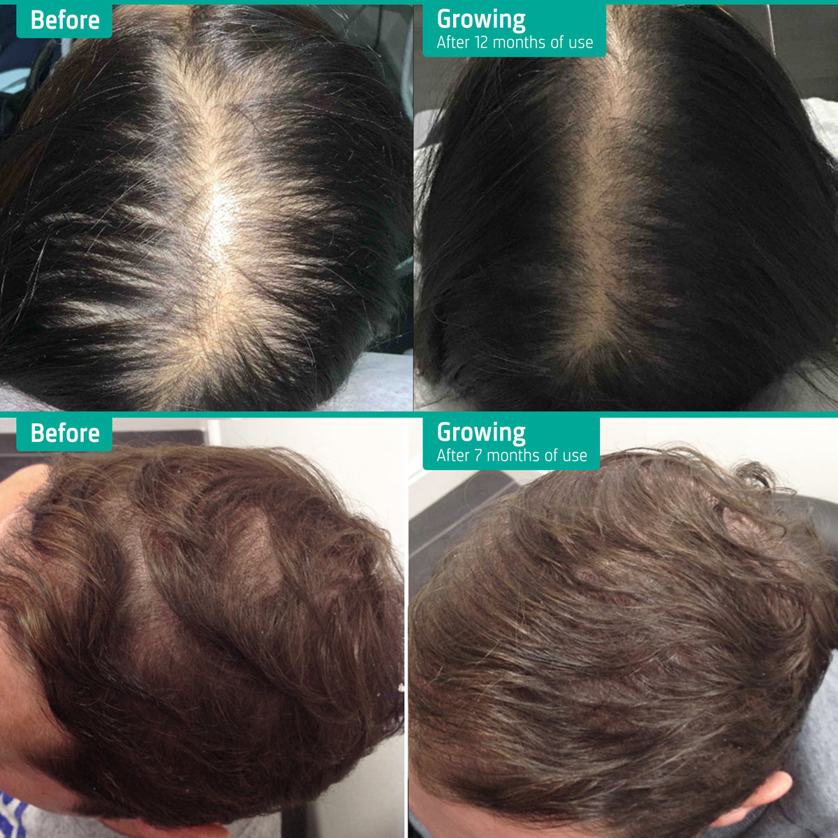 Hair Growth Supplements